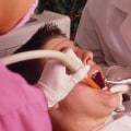 Facebook Ads for Dental Practices: A Comprehensive Overview