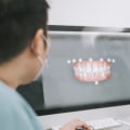Analyzing the Performance of Digital Dental Ads