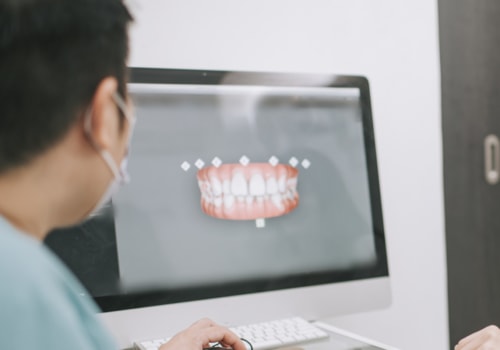 Analyzing the Performance of Digital Dental Ads