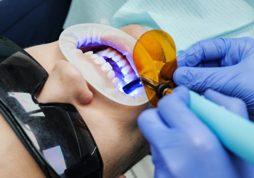 Writing Dental Email Copy